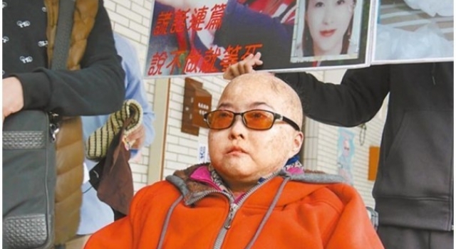台湾女子手术失败遭毁容 迅速衰老犹如70岁老人