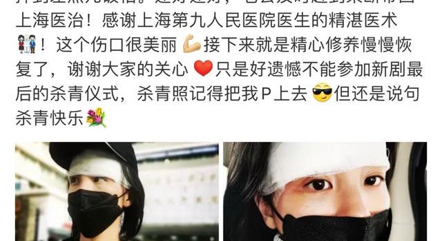 章龄之酒店摔倒险破相,头缠纱布眼皮红肿,陈龙安慰:依然是最美