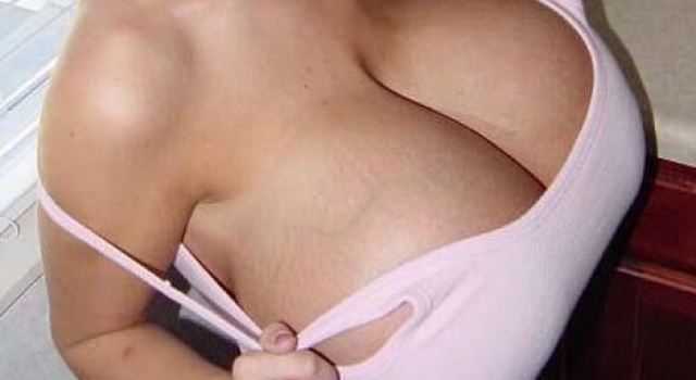 烟台女子患罕见巨乳症 乳房狂长似篮球