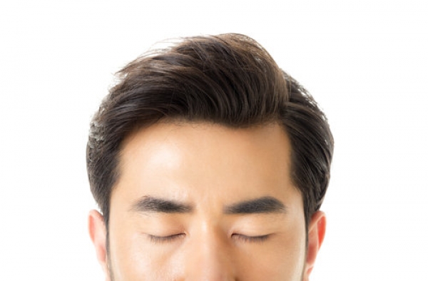 春季换季时头屑过多，头发干燥如何解决？