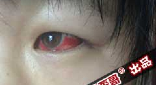 【叽歪哥 V0.103】初中生集体甲醛中毒:官方称合格 相关部门不管