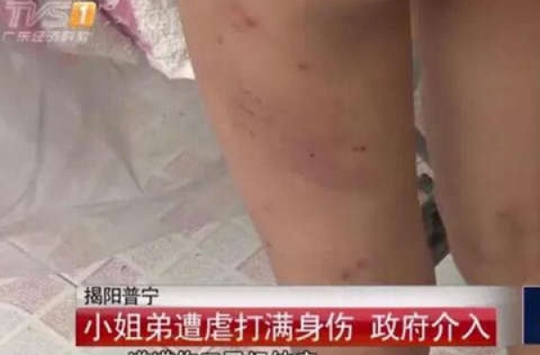 姐弟遭生父继母虐打体无完肤：浇一身尿 不给饭吃