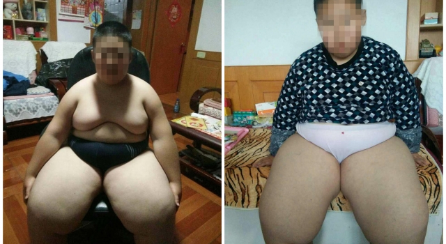 10岁小男孩体重182斤 坐着也能睡三年 单亲妈妈好烦恼