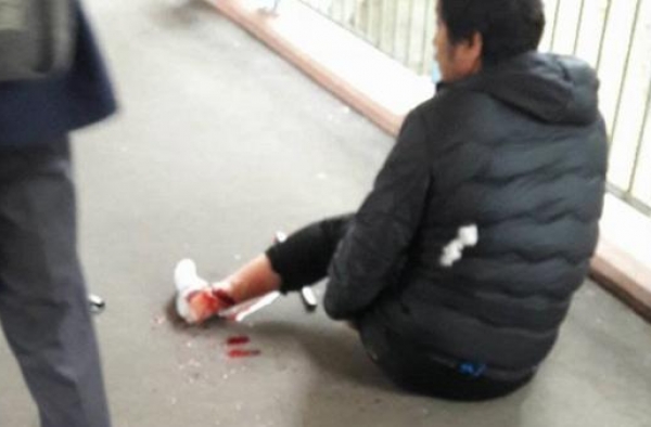 男子在港被匪徒斩断脚筋 400多万港元被抢走
