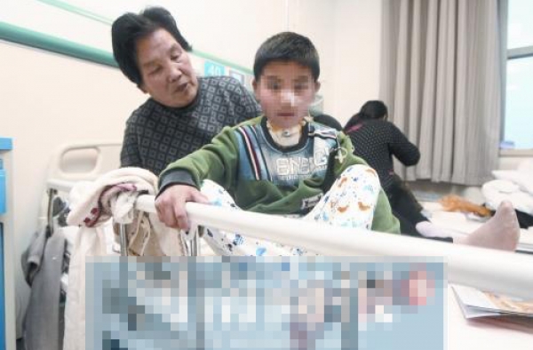 可怜!藏獒咬断3岁男童的喉咙 4年来喝水吃饭只能用是注射