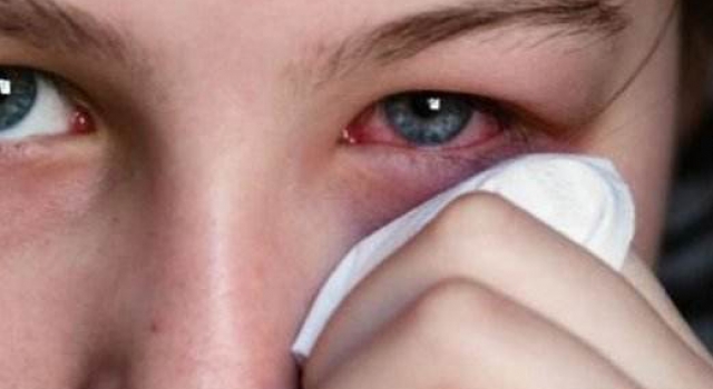 老人经常手擦眼睛导致失明 竟患上罕见眼结核