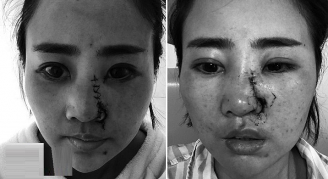 丽江女游客被打毁容案件宣判 丽江女游客被打事件始末