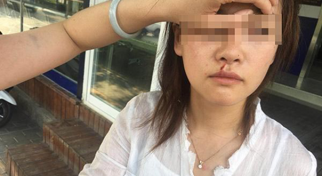 滴滴司机打伤乘客,司机被吐口水侮辱人被扇耳光
