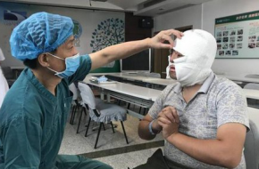 武汉小伙换脸成功 那他的未来是否也会变得幸运？