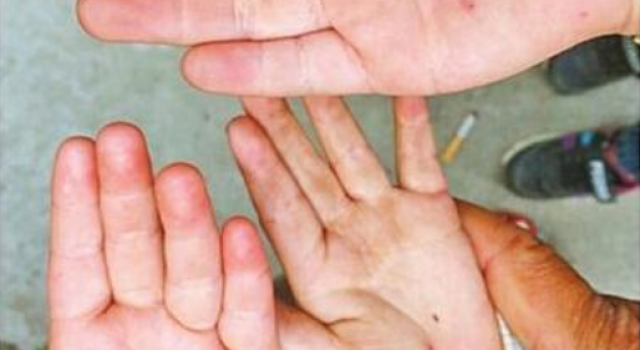 天津幼教针扎幼儿是怎么回事?现在幼儿园都这样管教?