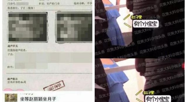 疑似赵丽颖怀孕六周B超照曝光 工作人员这样回应