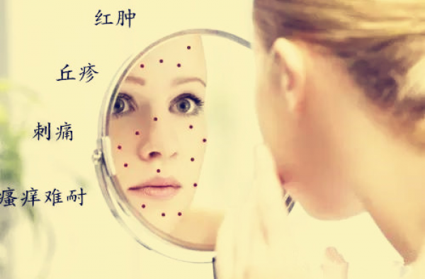 激素脸会自愈吗，激素脸用什么修复