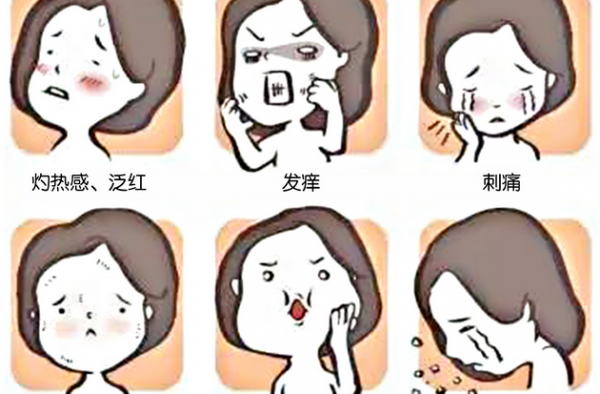 如何判断自己是不是激素脸？详解激素脸的主要症状有哪些