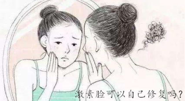 激素脸要怎么才能好？那么激素脸可以自己修复吗