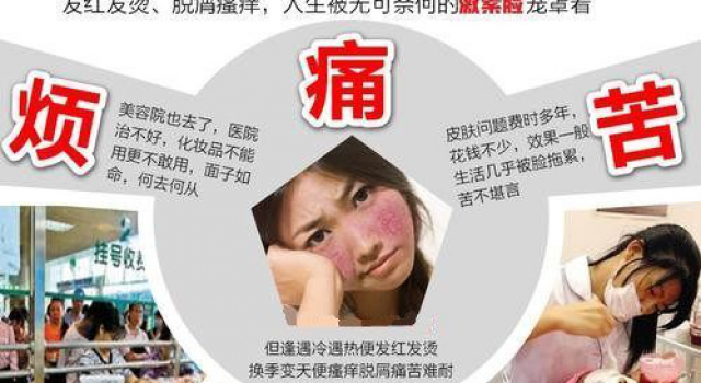 激素脸时好时坏怎么办？激素脸反复发作，时好时坏是反跳吗？