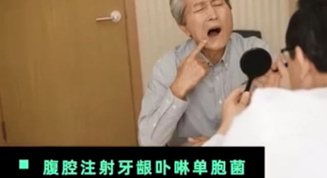 牙周炎可能导致阿尔茨海默病 网友：牙医要大赚一笔了