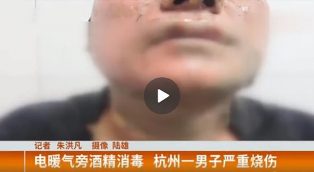 酒精消毒后烤电暖气全身着火 网友：消毒也要注意防火