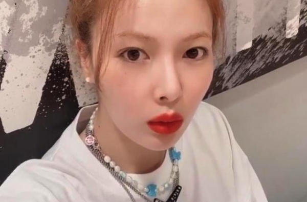 韩女星泫雅被曝患病后罕现身！疑因病情脱发严重，眼神空洞引担忧