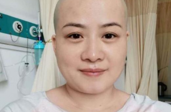 岳云鹏老婆术后晒照，从光头到寸头，调侃自己虎头虎脑超乐观