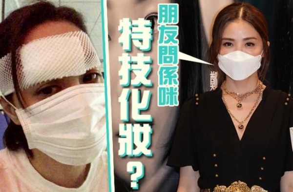 伤口有眉那么长！阿Sa赞阿娇年轻痊愈快 预计11月回港
