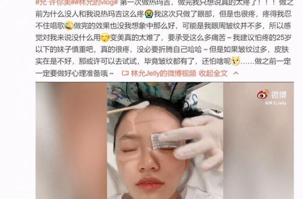 林允晒医美过程，自称疼到忍不住唱歌，建议25岁以下妹子慎重