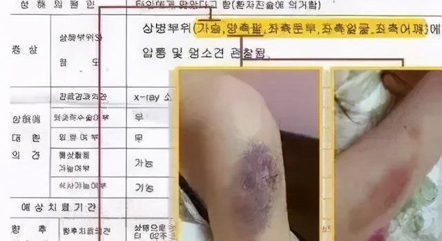 黄明昊，你最没资格卖惨