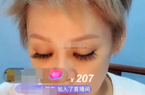 48岁宁静直播坑人？自称用刮痧板刮掉脸上的斑，网友：误人子弟